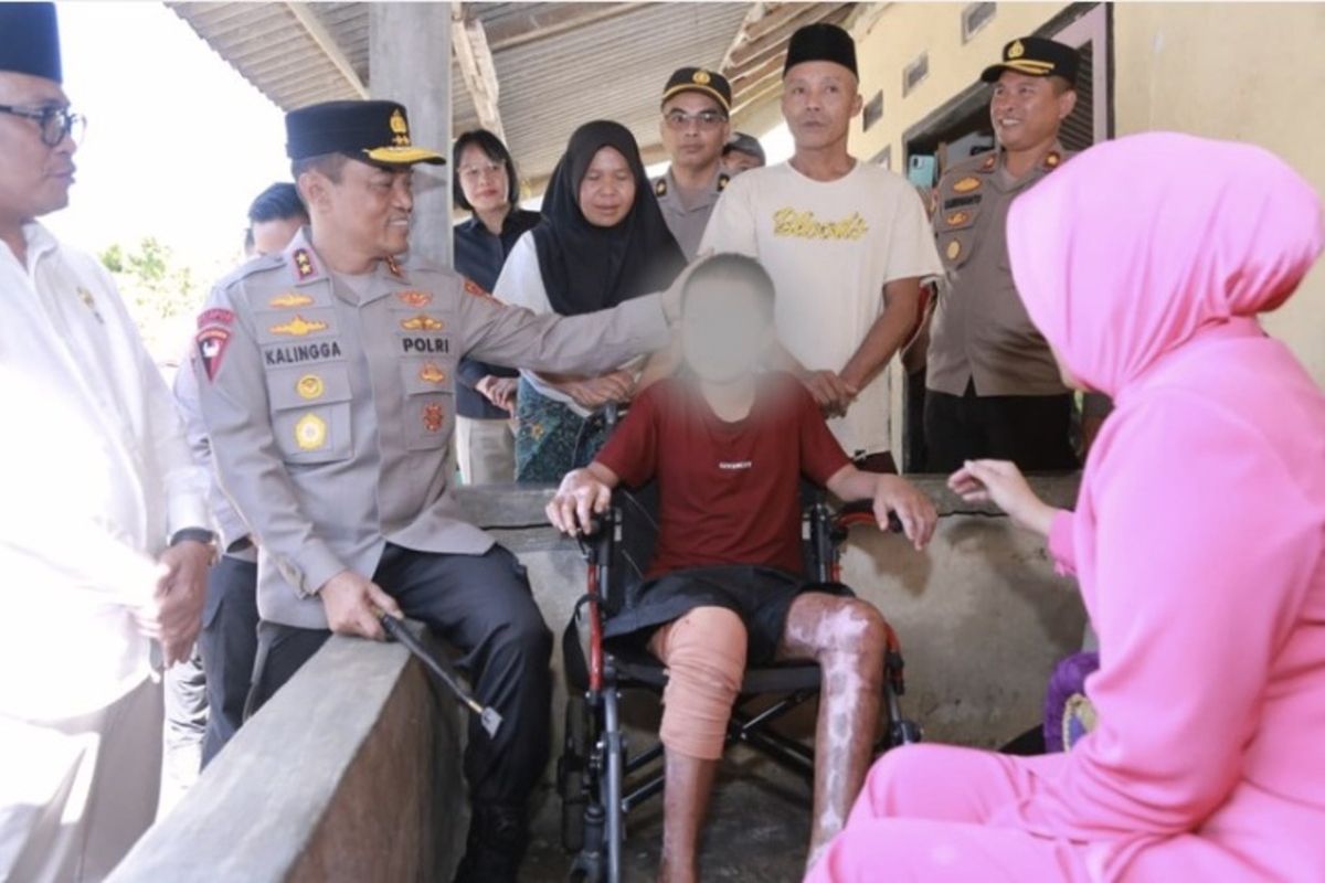 Upaya memperoleh keadilan bagi para korban dalam kasus pembakaran santri di sebuah pondok pesantren di Kabupaten Lombok Tengah, Nusa Tenggara Barat (NTB), terus berjalan. Pada Selasa (14/7/2026), Anggota Komisi XIII DPR RI Rieke Diah Pitaloka mendampingi keluarga korban saat mengajukan permohonan perlindungan kepada Lembaga Perlindungan Saksi dan Korban (LPSK). Peristiwa yang terjadi pada Desember 2025 tersebut menyebabkan tiga santri mengalami luka bakar dengan tingkat keparahan berbeda. Satu orang santri akhirnya meninggal dunia setelah menjalani perawatan akibat luka yang dideritanya. Rieke menegaskan bahwa negara harus memberikan perlindungan secara nyata kepada masyarakat, terutama kelompok rentan seperti perempuan dan anak. "Negara tidak boleh hadir hanya setelah korban berjatuhan, tetapi harus memastikan setiap warga negara, khususnya perempuan dan anak, memperoleh pelindungan hukum, rasa aman, dan keadilan," ujar Rieke dalam keterangannya, Selasa. Menurut Rieke, para korban membutuhkan pendampingan selama seluruh proses hukum berlangsung agar mereka dapat menyampaikan keterangan tanpa tekanan dari pihak mana pun. "Korban dan keluarganya mengajukan permohonan pelindungan kepada Lembaga Pelindungan Saksi dan Korban (LPSK) guna memastikan terpenuhinya hak korban atas pelindungan, pendampingan, pemulihan fisik dan psikologis, serta restitusi," jelasnya. Dalam insiden tersebut, santri berinisial ADR (14) dan SAH (12) mengalami luka bakar serius. Sementara itu, MYS (14) menderita luka ringan. Adapun MSS (13) meninggal dunia pada 19 Februari 2026 setelah menjalani perawatan intensif akibat luka bakar yang dialaminya. Menindaklanjuti permohonan tersebut, LPSK langsung membentuk tim untuk melakukan asesmen terhadap para korban. Wakil Ketua LPSK Sri Nurherwati mengatakan lembaganya telah memberikan perlindungan darurat sekaligus melakukan pemeriksaan medis kepada korban yang masih menjalani perawatan. "LPSK sudah menunjuk tim untuk dilakukan perlindungan secara darurat ya, secara darurat, dan saat ini korban juga sedang menjalani assessment medis, ada di sini ya," kata Sri. Selain memberikan pendampingan kepada korban yang masih hidup, LPSK juga berencana menemui keluarga santri yang meninggal dunia. Hingga saat ini, lembaga tersebut baru menerima dua permohonan perlindungan dari korban luka bakar. "Kemungkinan ya (datangi korban meninggal). Baru ada dua itu tadi ya, yang hari ini. Kita enggak tahu apakah nanti yang lain akan mengajukan permohonan karena memang basis kerja LPSK berdasarkan permohonan," ujar Sri. Sri menjelaskan bahwa bentuk perlindungan yang diberikan LPSK tidak terbatas pada layanan kesehatan. Korban juga akan mendapatkan pendampingan selama proses hukum berlangsung serta perlindungan terhadap hak-hak prosedural mereka. "Saat ini medis, kemudian juga perlindungan yang lain ya saya kira. Terutama tentunya pendampingan hak prosedural. Dan itu kan saya kira tadi kuasa hukum juga sudah ada, berarti kita bisa bekerja sama," katanya. Di sisi lain, tim kuasa hukum korban mengungkap dugaan adanya perundungan yang dialami para korban sebelum insiden kebakaran terjadi. Kuasa hukum korban, Putri Maya Rumanti, menyampaikan bahwa hasil penelusuran bersama para relawan menemukan indikasi dua korban sebelumnya sering menjadi sasaran intimidasi oleh dua orang yang kini diduga sebagai pelaku. "Kami mendapatkan info bahwa adik-adik ini sebelum kejadian ini pernah menjadi korban pembullyan oleh pelaku, dua orang pelaku," ungkap Putri. Ia menyebut kedua terduga pelaku berinisial MR dan Y. Menurutnya, Y merupakan anak pemilik pondok pesantren. Putri menjelaskan, MR diduga beberapa kali mencoret tubuh salah satu korban, sedangkan Y diduga melakukan kekerasan fisik terhadap korban dalam beberapa kesempatan. Sementara itu, Kasat Reskrim Polres Lombok Tengah AKP Punguan Hutahaean menjelaskan bahwa kejadian bermula pada 13 Desember 2025 sekitar pukul 13.00 Wita saat para santri sedang beristirahat. Berdasarkan hasil penyelidikan, tersangka MR meminta korban MSS membeli satu liter bensin. Bahan bakar tersebut rencananya dipakai sebagai pengganti tiner untuk dicampurkan ke dalam cat yang akan digunakan mengecat ulang dinding kamar. Setelah bensin diperoleh, MR mengajak beberapa santri berkumpul di sebuah kamar kosong untuk membuat katapel. Di lokasi itu mereka mencoba membakar sepotong kayu menggunakan bensin. Namun api tiba-tiba menyambar sisa bahan bakar yang masih berada di dalam botol sehingga kobaran api membesar dan membakar kasur di ruangan tersebut. Dalam kepanikan, dua santri termasuk MR berhasil keluar dari kamar. Namun tiga santri lainnya tidak dapat segera menyelamatkan diri karena pintu ruangan hanya bisa dibuka ke arah dalam sehingga menyulitkan mereka saat berusaha keluar. Polres Lombok Tengah kemudian menetapkan dua tersangka dalam perkara ini, yakni MR (15) yang merupakan santri senior dan AM (55) selaku pimpinan pondok pesantren. Keduanya dijerat Pasal 359 dan/atau Pasal 360 ayat (1) KUHP juncto Pasal 474 ayat (2) dan ayat (3) Undang-Undang Nomor 1 Tahun 2023 tentang KUHP karena diduga lalai hingga menyebabkan korban meninggal dunia dan korban lainnya mengalami luka berat. Penyidik menilai MR mengabaikan peringatan dari rekan-rekannya sebelum insiden terjadi. Sementara itu, AM diduga tidak menjalankan fungsi pengawasan terhadap para santri sebagaimana mestinya. AKP Punguan Hutahaean menjelaskan bahwa berdasarkan ketentuan yang berlaku, pondok pesantren wajib memiliki sistem pengasuhan dengan melibatkan pembimbing, pengasuh, serta tenaga pendidik yang memadai. Namun, hasil penyelidikan menunjukkan bahwa saat kejadian berlangsung, pengasuhan hanya dilakukan oleh pimpinan pondok pesantren bersama istrinya. "Dari dokumen yang kami peroleh, pada tahun-tahun sebelumnya ada pengasuh yang direkrut. Namun pada tahun kejadian, yang berperan sebagai pengasuh hanya tuan guru dan istrinya, sehingga terurai unsur kelalaian sebagaimana pasal yang kami sangkakan," ujar Punguan.